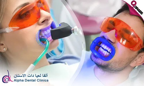 Fläsh Teeth Whitening at Alpha Dental Clinics!